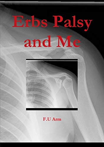 Erbs Palsy and Me