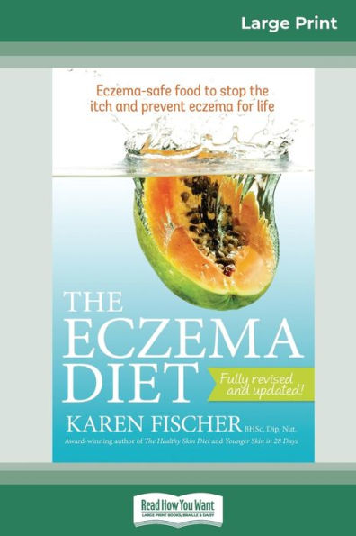 The Eczema Diet (2Nd Edition): Eczema-Safe Food To Stop The Itch And Prevent Eczema For Life (16Pt Large Print Edition)