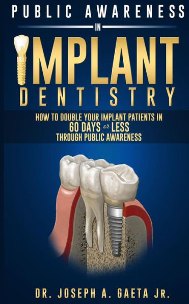 Public Awareness In Implant Dentistry: How To Double Your Implant Patients In 60 Days Or Less Through Public Awareness