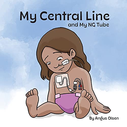 My Central Line And My Ng Tube