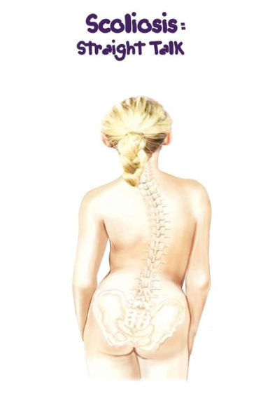Scoliosis: Straight Talk (Book 2)