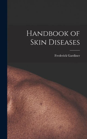 Handbook Of Skin Diseases