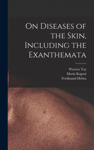 On Diseases Of The Skin, Including The Exanthemata