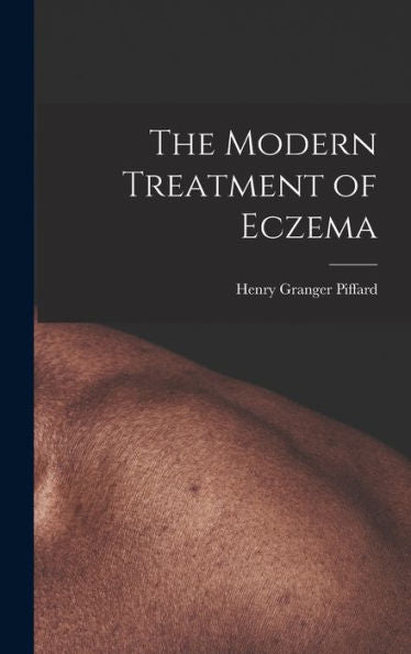 The Modern Treatment Of Eczema