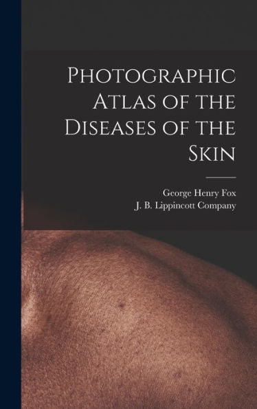 Photographic Atlas Of The Diseases Of The Skin