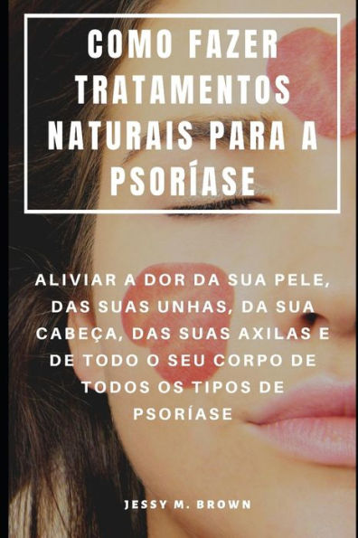 Como Fazer Tratamentos Naturais Para A Psoríase : Aliviar A Dor Da Sua Pele, Das Suas Unhas, Da Sua Cabeça, Das Suas Axilas E De Todo O Seu Corpo De Todos Os Tipos De Psoríase (Portuguese Edition)