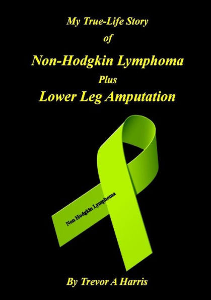 My True-Life Story Of Non-Hodgkin Lymphoma Plus Amputation