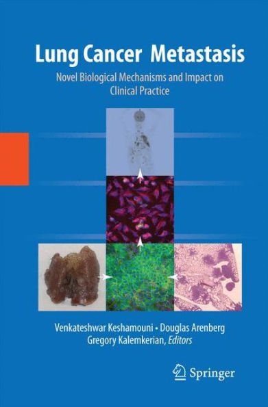 Lung Cancer Metastasis: Novel Biological Mechanisms And Impact On Clinical Practice