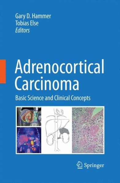 Adrenocortical Carcinoma: Basic Science And Clinical Concepts
