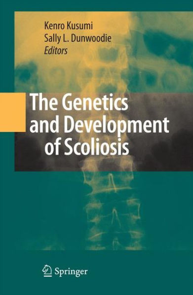 The Genetics And Development Of Scoliosis