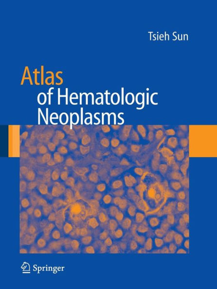 Atlas Of Hematologic Neoplasms