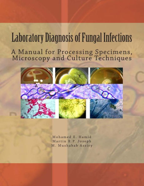 Laboratory Diagnosis Of Fungal Infections: A Manual For Processing Specimens, Microscopy And Culture Techniques