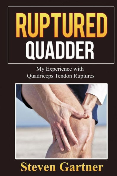Ruptured Quadder: My Experience With Bilateral Quadriceps Tendon Rupture