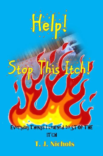 Help! Stop This Itch!