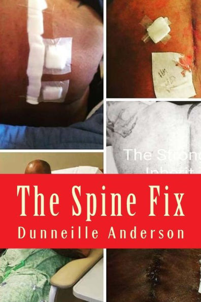 The Spine Fix : Life Lessons On Overcoming Spinal Surgery And Improving Your Quality Of Life