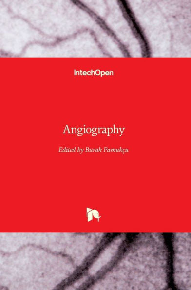 Angiography