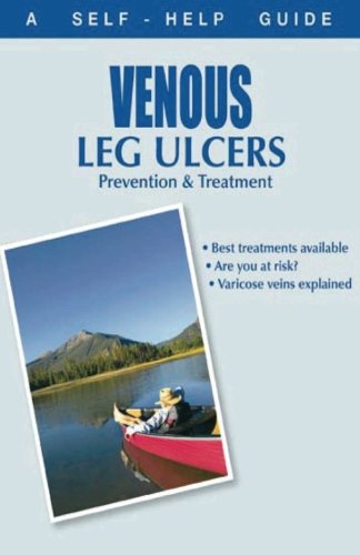 The Doctor's Guide To: Venous Leg Ulcers: Prevention And Treatment (Dr. Guide Books)