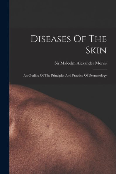 Diseases Of The Skin: An Outline Of The Principles And Practice Of Dermatology