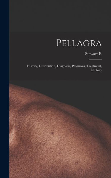 Pellagra: History, Distribution, Diagnosis, Prognosis, Treatment, Etiology - 9781018542713