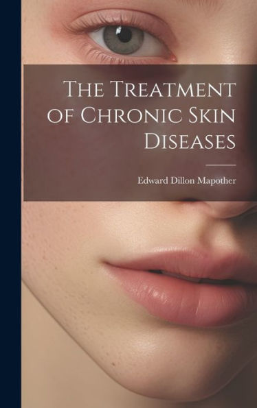 The Treatment Of Chronic Skin Diseases