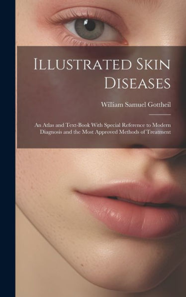 Illustrated Skin Diseases: An Atlas And Text-Book With Special Reference To Modern Diagnosis And The Most Approved Methods Of Treatment - 9781020253379