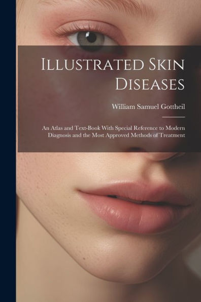 Illustrated Skin Diseases: An Atlas And Text-Book With Special Reference To Modern Diagnosis And The Most Approved Methods Of Treatment - 9781021611604