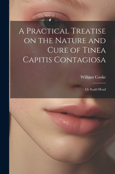 A Practical Treatise On The Nature And Cure Of Tinea Capitis Contagiosa: Or Scald Head