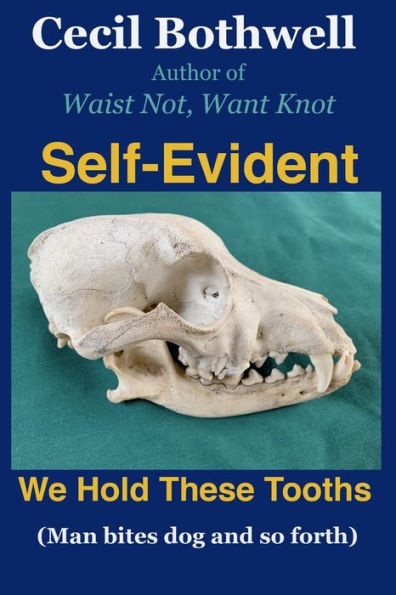 Evidente: sostenemos estos dientes