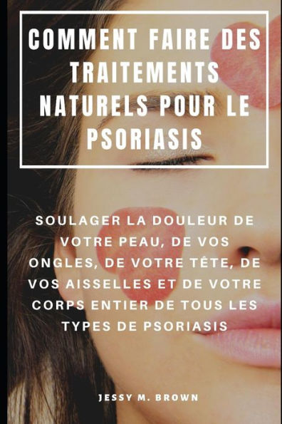 Comment Faire Des Traitements Naturels Pour Le Psoriasis : Soulager La Douleur De Votre Peau, De Vos Ongles, De Votre Tête, De Vos Aisselles Et De ... Tous Les Types De Psoriasis (French Edition)