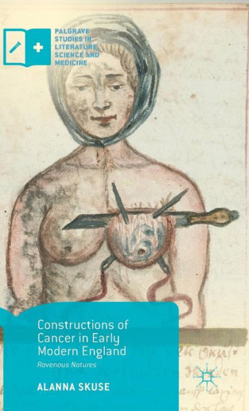 Constructions Of Cancer In Early Modern England: Ravenous Natures (Palgrave Studies In Literature, Science And Medicine) - 9781137487520