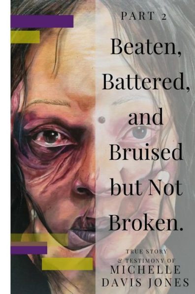 Beaten, Battered, and Bruised, but Not Broken