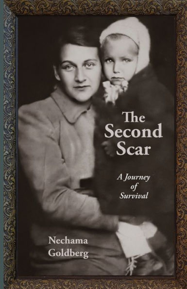 The Second Scar: A Journey Of Survival