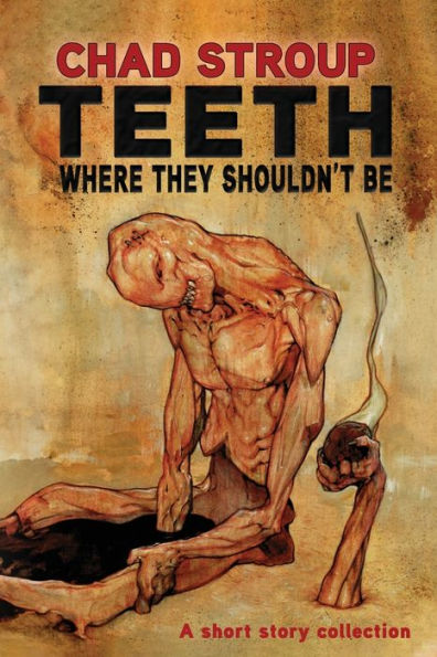 Dientes donde no deberían estar