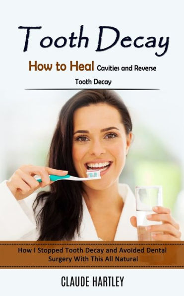 Caries: Cómo curar las caries y revertir las caries (cómo detuve las caries y evité la cirugía dental con esto totalmente natural) - 9781998038169