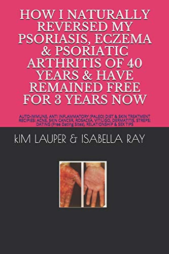 HOW I NATURALLY REVERSED MY PSORIASIS, ECZEMA AND PSORIATIC ARTHRITIS OF 40 YEARS AND HAVE REMAINED FREE FOR 3 YEARS NOW: AUTO IMMUNE, GLUTEN FREE, ... RELATIONSHIP (Free Dating Sites) & SEX TIPS