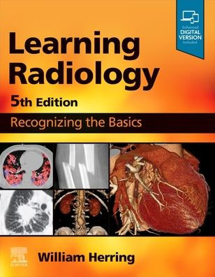Learning Radiology: Recognizing The Basics