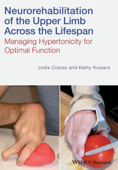 Neurorehabilitation Of The Upper Limb Across The Lifespan: Managing Hypertonicity For Optimal Function