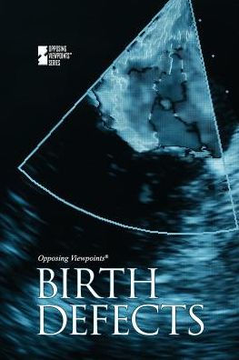 Birth Defects (Opposing Viewpoints)