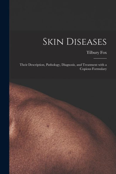 Skin Diseases [Electronic Resource]: Their Description, Pathology, Diagnosis, And Treatment With A Copious Formulary