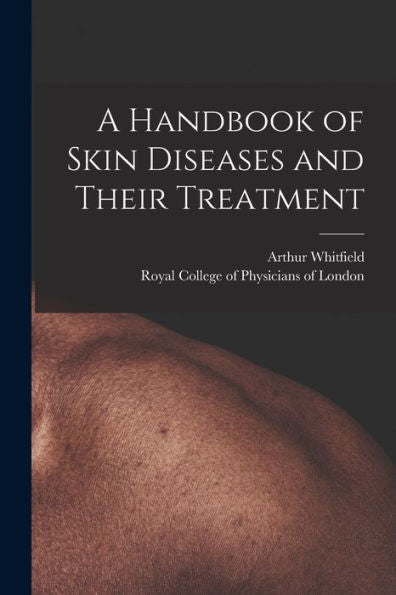A Handbook Of Skin Diseases And Their Treatment