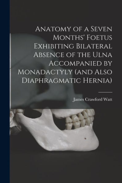 Anatomy Of A Seven Months' Foetus Exhibiting Bilateral Absence Of The Ulna Accompanied By Monadactyly (And Also Diaphragmatic Hernia) [Microform]