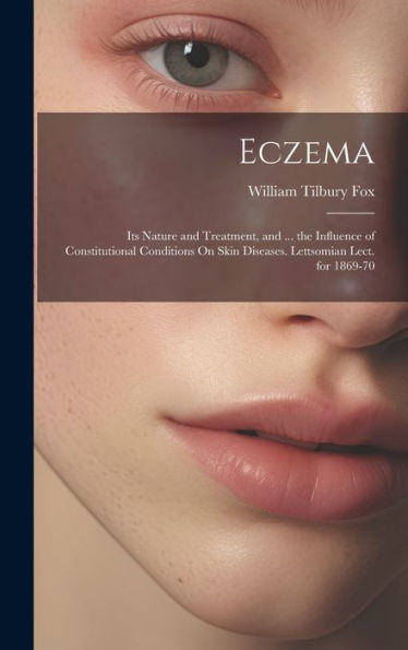 Eczema: Its Nature And Treatment, And ... The Influence Of Constitutional Conditions On Skin Diseases. Lettsomian Lect. For 1869-70