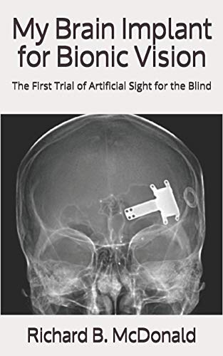 My Brain Implant For Bionic Vision: The First Trial Of Artificial Sight For The Blind