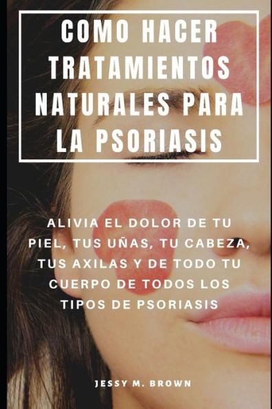 COMO HACER TRATAMIENTOS NATURALES PARA LA PSORIASIS : ALIVIA EL DOLOR DE TU PIEL, TUS U?AS, TU CABEZA, TUS AXILAS Y DE TODO TU CUERPO DE TODOS LOS TIPOS DE PSORIASIS (Spanish Edition)