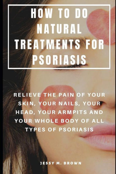 HOW TO DO NATURAL TREATMENTS FOR PSORIASIS : RELIEVE THE PAIN OF YOUR SKIN, YOUR NAILS, YOUR HEAD, YOUR ARMPITS AND YOUR WHOLE BODY OF ALL TYPES OF PSORIASIS