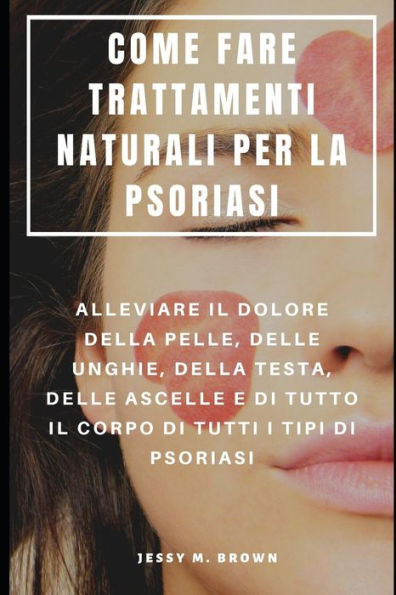Come Fare Trattamenti Naturali Per La Psoriasi : Alleviare Il Dolore Della Pelle, Delle Unghie, Della Testa, Delle Ascelle E Di Tutto Il Corpo Di Tutti I Tipi Di Psoriasi (Italian Edition)