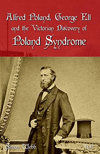 Alfred Poland, George Elt And The Victorian Discovery Of Poland Syndrome