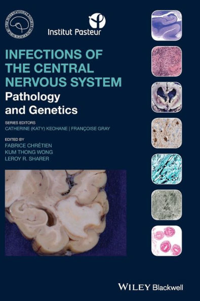 Infections Of The Central Nervous System: Pathology And Genetics (International Society Of Neuropathology Series)