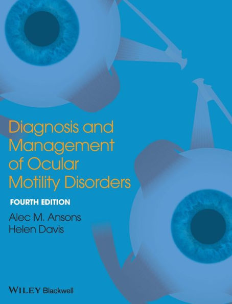 Diagnosis And Management Of Ocular Motility Disorders