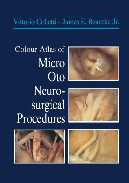 Colour Atlas Of Micro-Oto-Neurosurgical Procedures